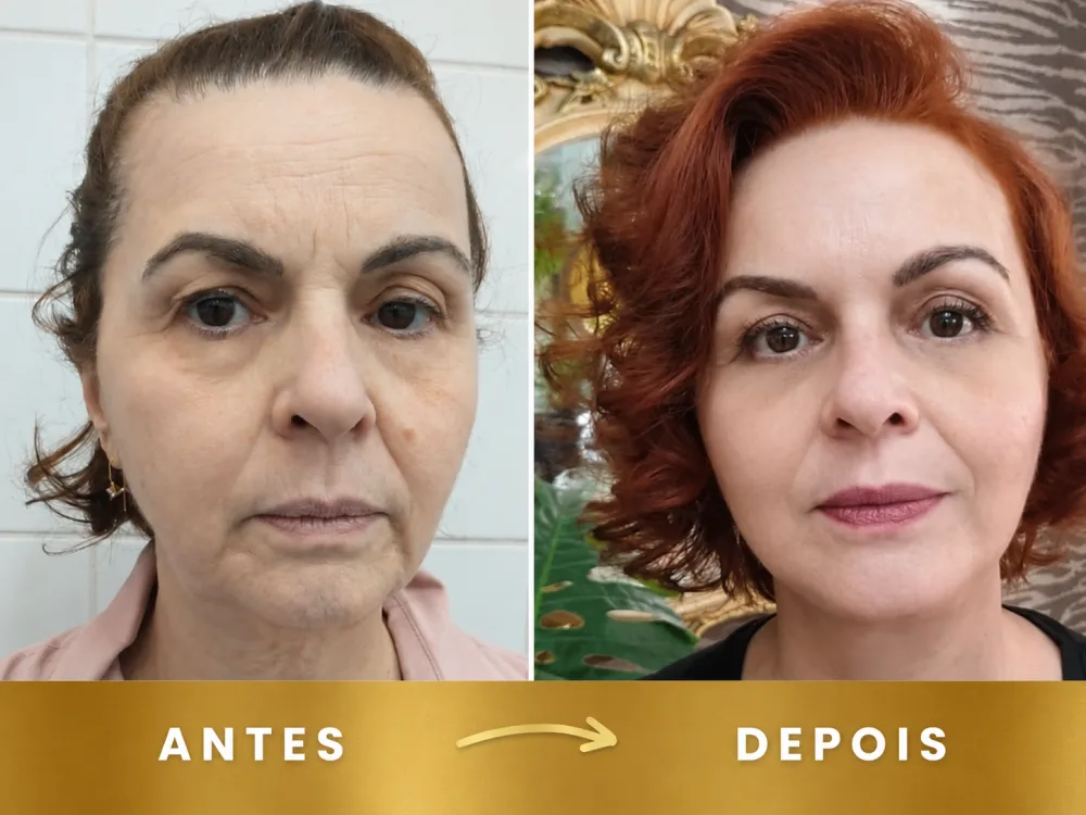 Resultado 4